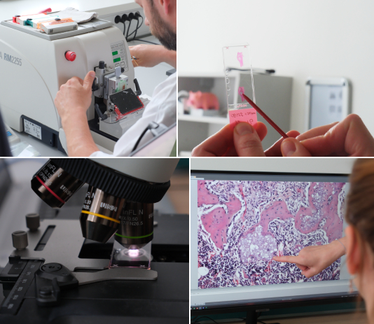 PROFiBONE - histologie