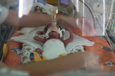 Referenn obrzek - Optimalizace lby syndromu dechov tsn u novorozenc velmi nzk porodn hmotnosti